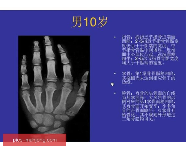 大道速滑骨龄评估，科学选材保障长远发展